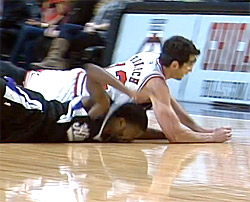 Aïe : Aaron Brooks perd une dent sur le parquet !