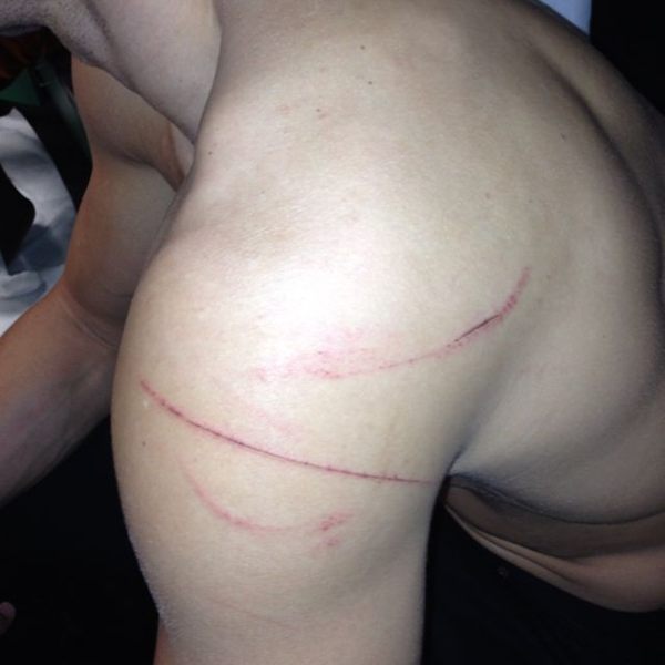Bagarre : Kris Humphries poste une photo de ses blessures