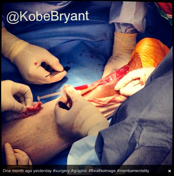 Gore : Kobe Bryant poste une photo de son opération (âmes sensibles s’abstenir)