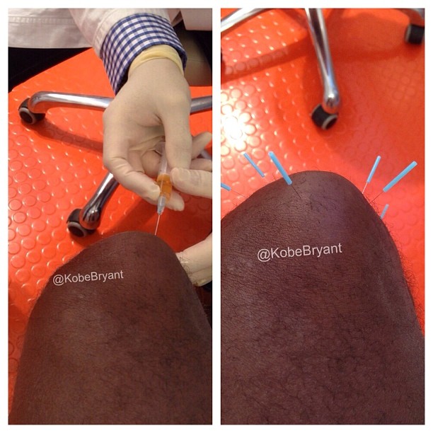 Photo : Les images du traitement de Kobe Bryant en Allemagne