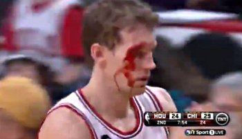 Vidéo : Dunleavy se fait éclater l’arcade par Parsons