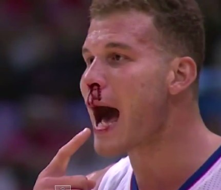 Vidéo : Blake Griffin le nez en sang