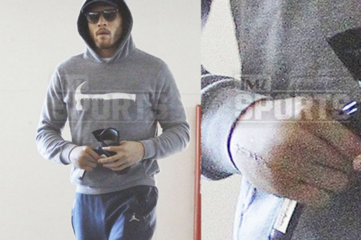 Flippant : La main de Blake Griffin fait peur à voir !