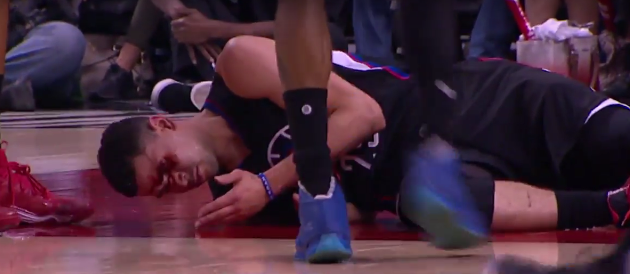 Austin Rivers en sang après un coup de coude !