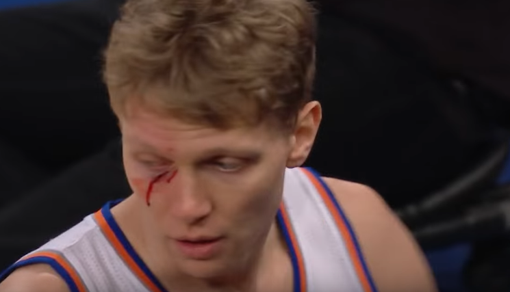 Gore : Visage ensanglanté pour Kuzminskas après un « coup de poing »