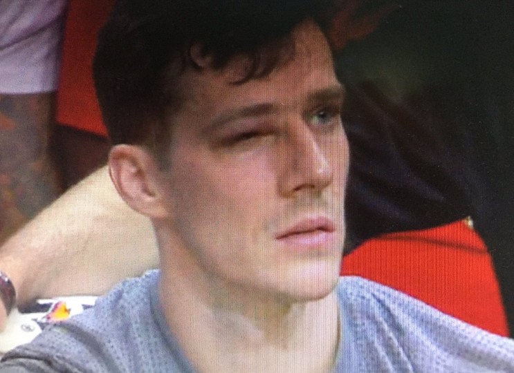 Blessé à l’oeil, Goran Dragic hérite d’un nouveau surnom