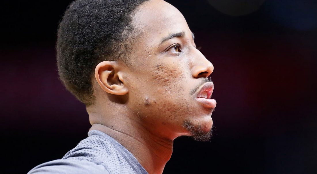 CQFR : DeRozan sanctionne l’énorme craquage des Celtics