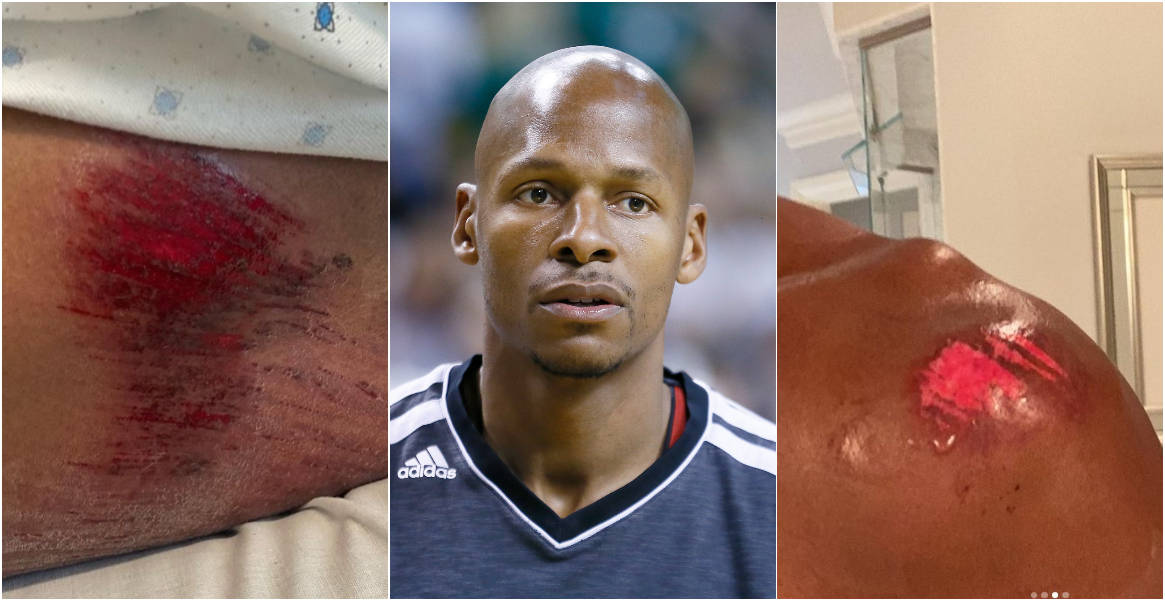 Ray Allen s’est fait une énorme frayeur : « Ma tête a heurté le sol »